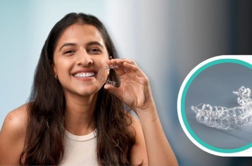 Why Invisalign Attachment Buttons Accelerate Complex Tooth Rotations Without Compromising Aesthetics