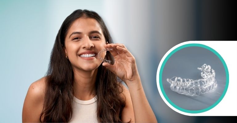 Why Invisalign Attachment Buttons Accelerate Complex Tooth Rotations Without Compromising Aesthetics